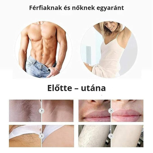 IPL otthoni szőrtelenítő férfiaknak és nőknek – előtte és utána