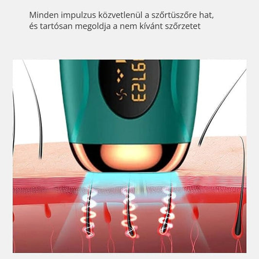 IPL szőrtelenítő – az impulzus közvetlenül a szőrtüszőre hat