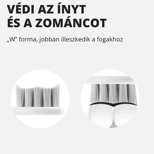 Oclean fogkefe pótfej – védi az ínyt és a fogzománcot, W forma