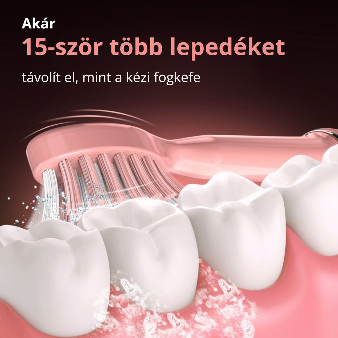 Sejoy szonikus fogkefe – akár 15-ször több lepedéket távolít el