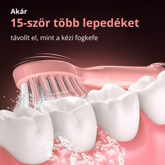 Sejoy szonikus fogkefe – akár 15-ször több lepedéket távolít el